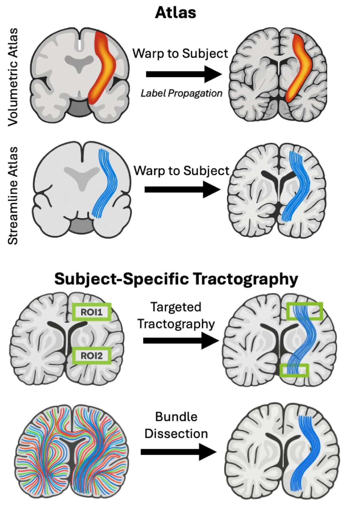 Comparison of atlas propagation and subject-specific tractography workflows.