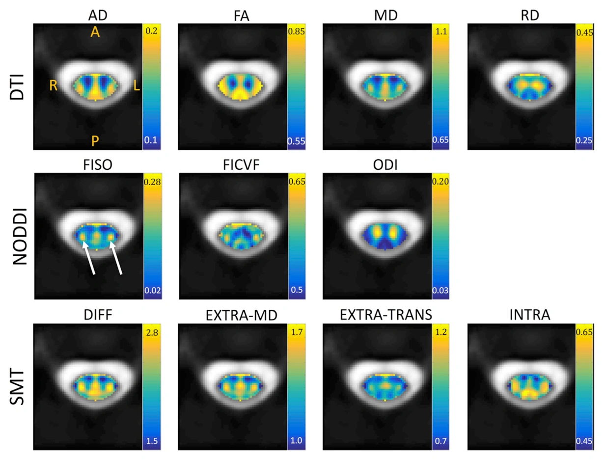 Population-average DTI, NODDI, and spherical mean technique parameter maps in the cervical spinal cord.