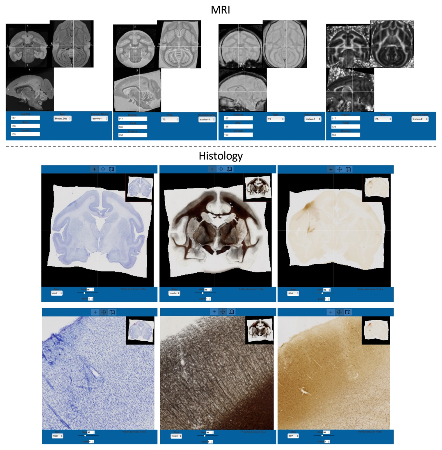 MRI contrasts and matched histological modalities included in the squirrel monkey atlas.
