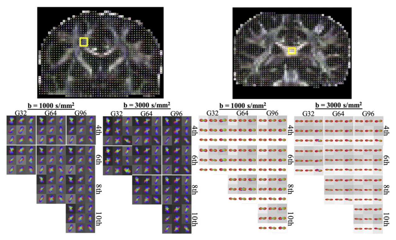 Q-ball orientation estimates across diffusion weightings, gradient counts, and spherical harmonic orders.
