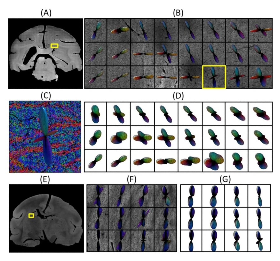 Comparison of histological and diffusion MRI fiber orientations in crossing and fanning regions.