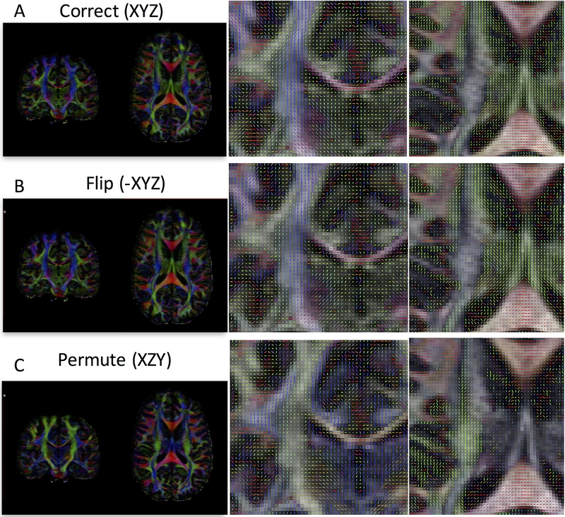 Correct, flipped, and permuted diffusion gradient tables produce different orientation patterns.