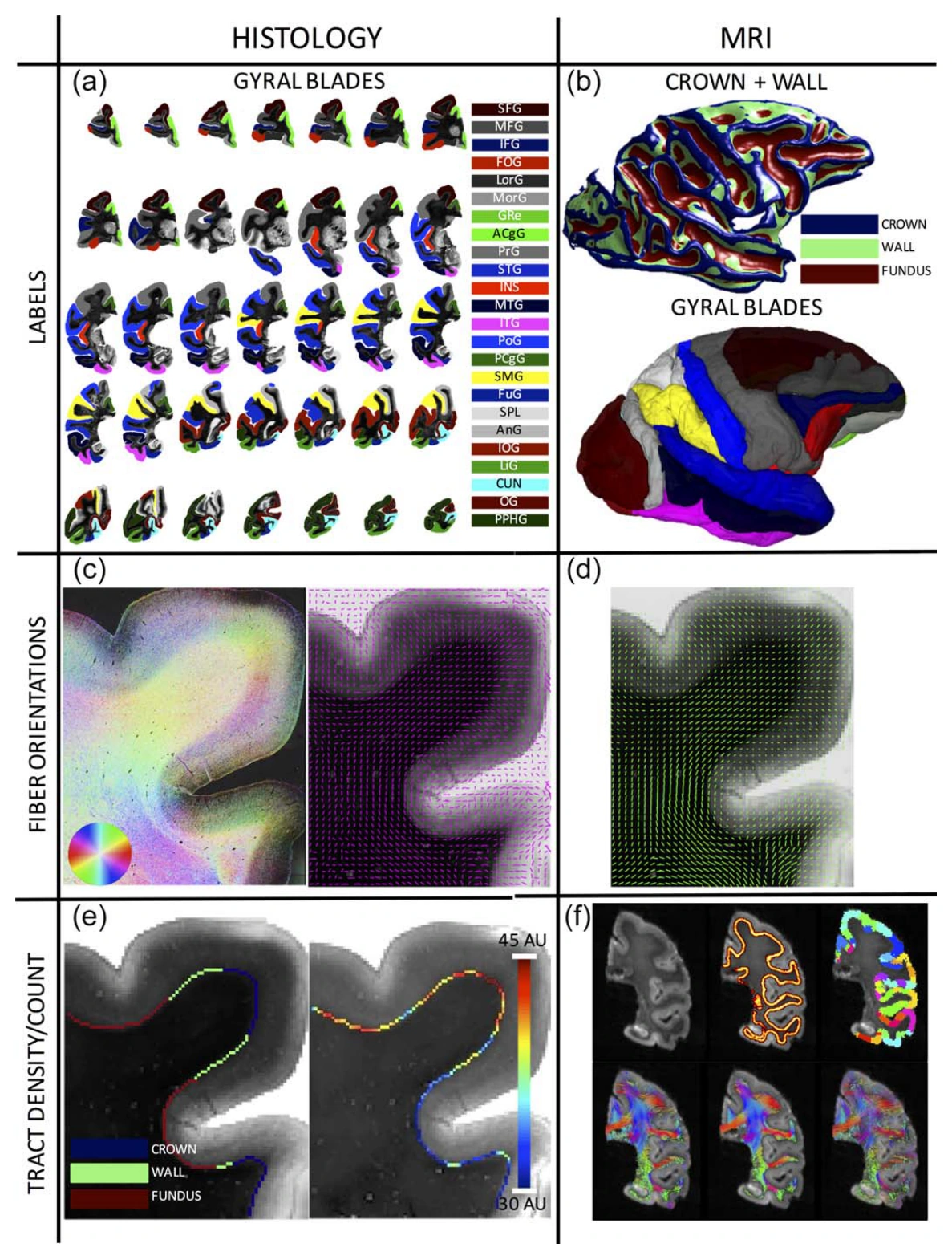 Histology and diffusion MRI workflow for testing tractography bias across gyral blades.