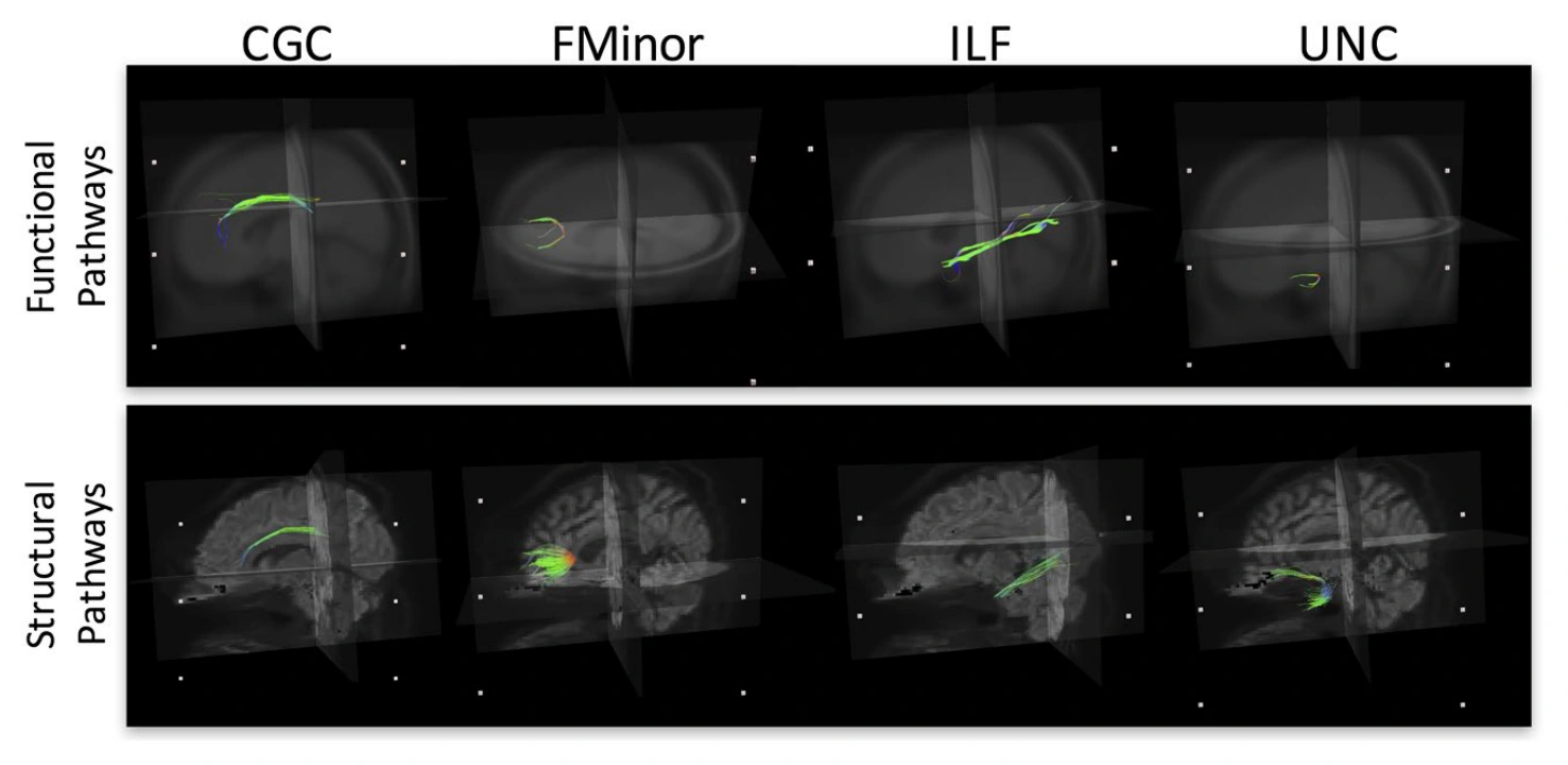 HARFI functional pathways compared with familiar structural white matter pathways.