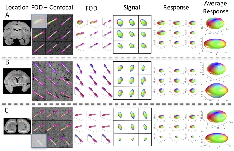 Histologically derived fiber response functions vary across regions of the same brain.