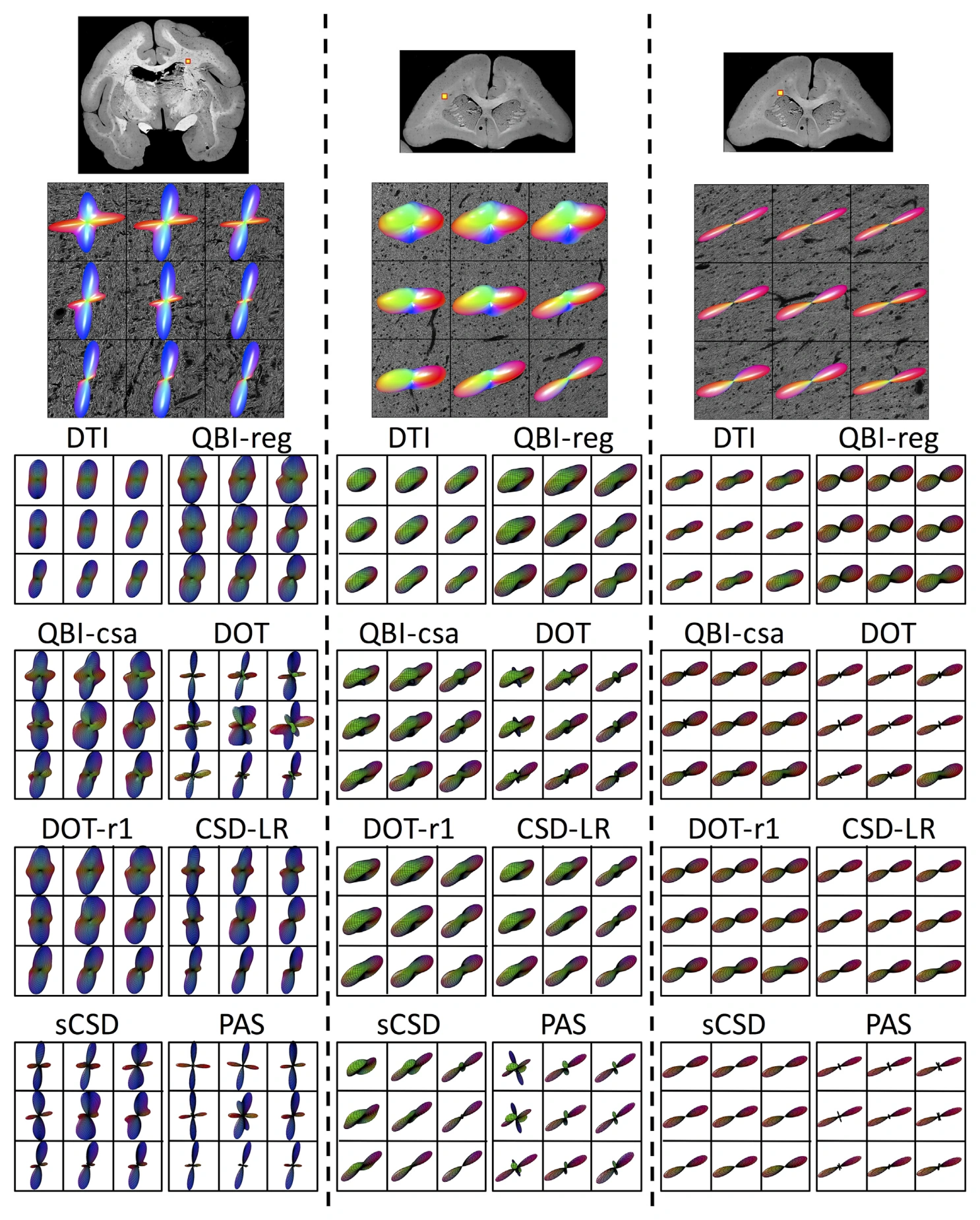 Histological fiber orientations compared with eight diffusion MRI reconstruction methods.