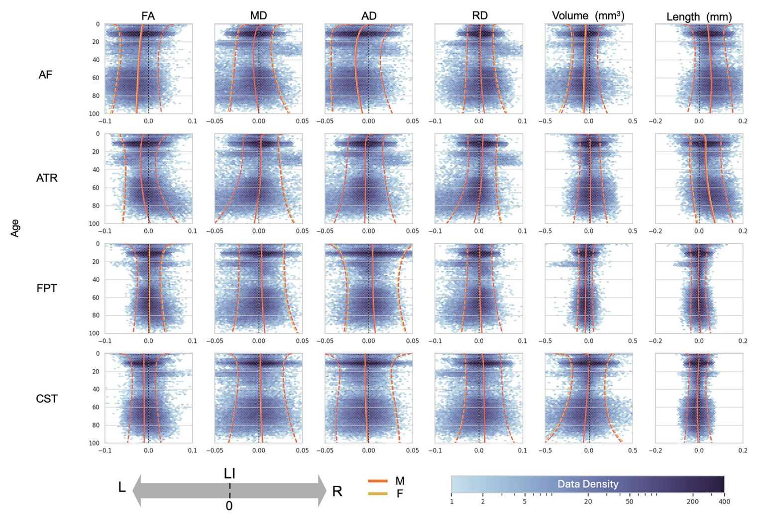 Examples of age-dependent white matter asymmetry across microstructural and macrostructural features.