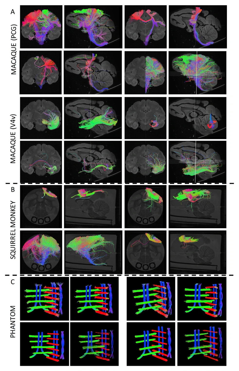Tractography submissions reconstructed the same validation pathways with markedly different spatial extents.