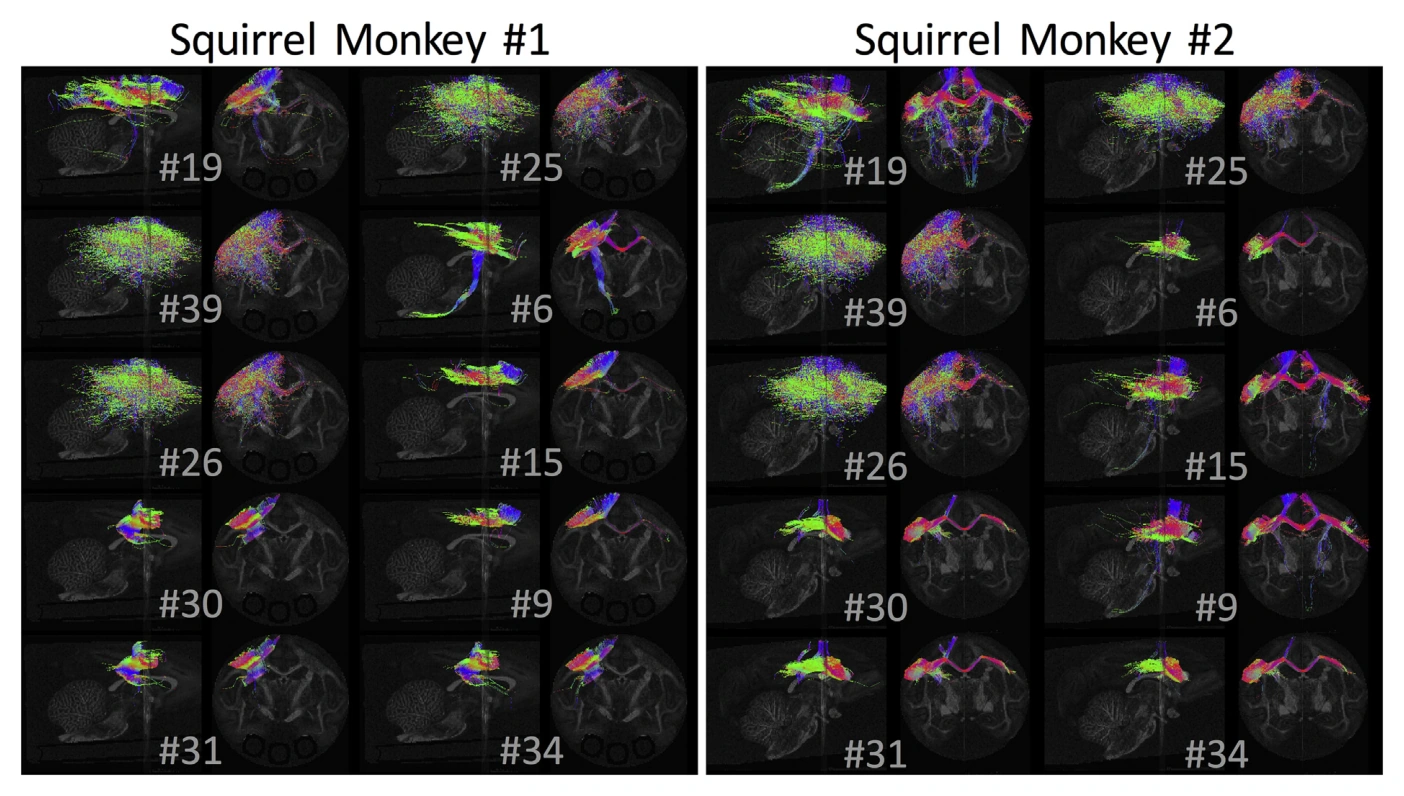 Variation among standard-practice reconstructions of motor pathways in the squirrel monkey brain.