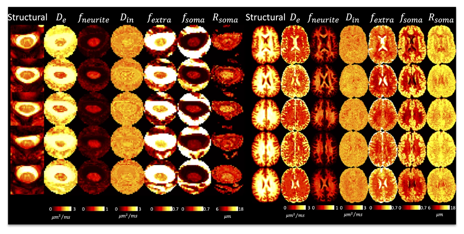 SANDI neurite and soma parameter maps in the brain and cervical spinal cord.