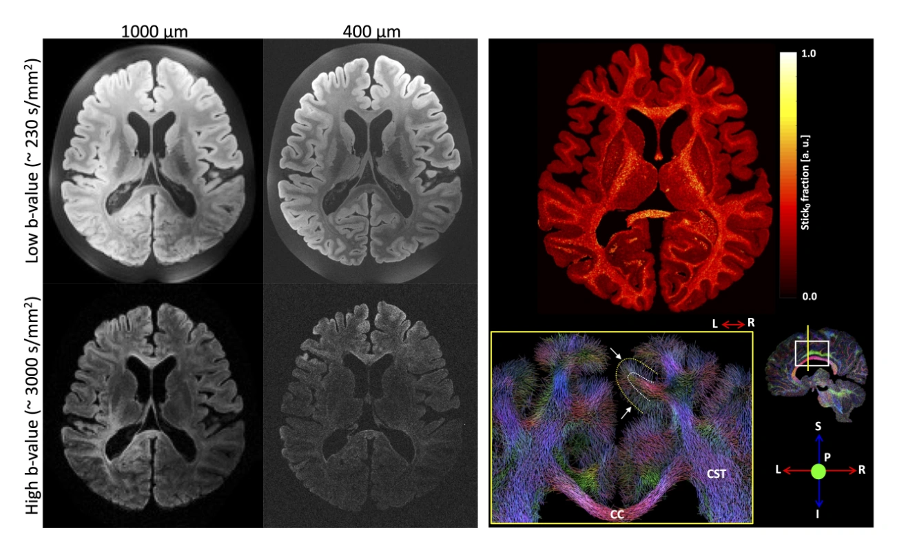 High-resolution ex vivo human imaging supports detailed tissue maps and tractography.