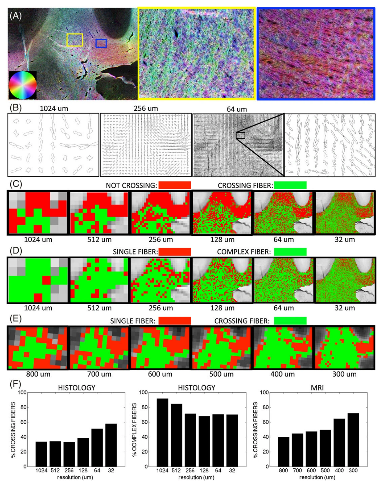 Histology and diffusion MRI reveal fiber geometry and crossing-fiber estimates across spatial scales.