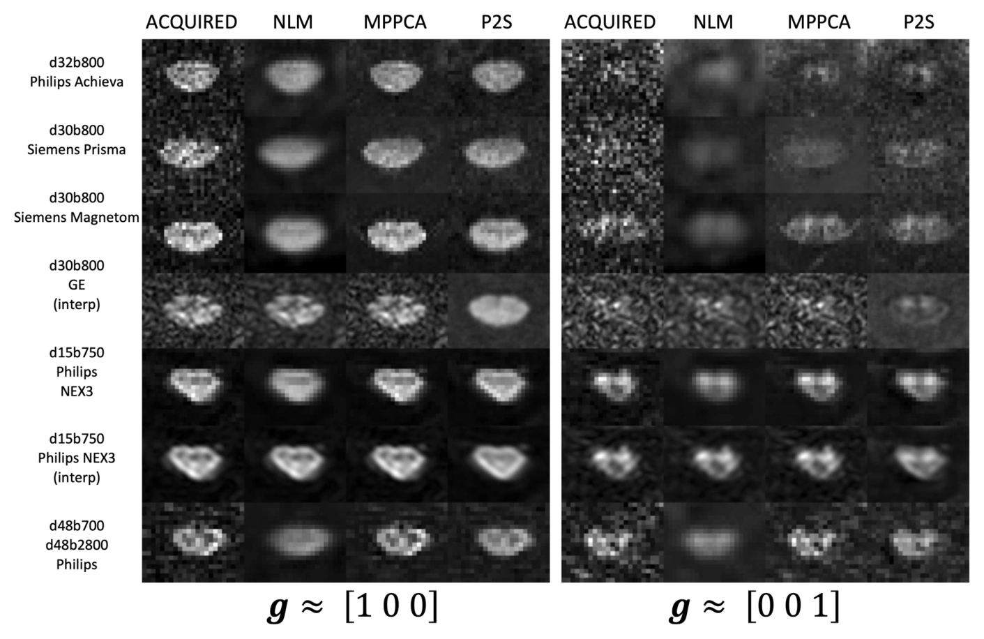 Spinal cord diffusion images before and after denoising across vendors and acquisition settings.