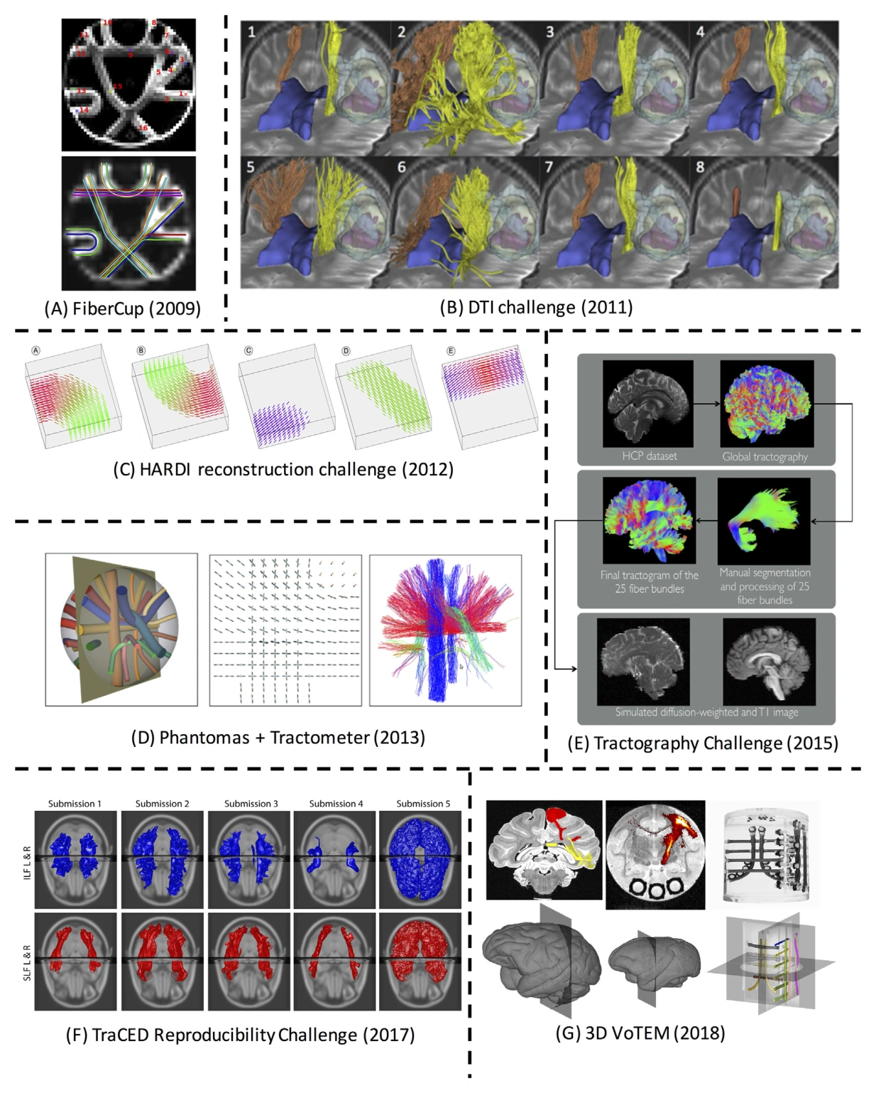 Overview of benchmark datasets and anatomical references used in tractography challenges.