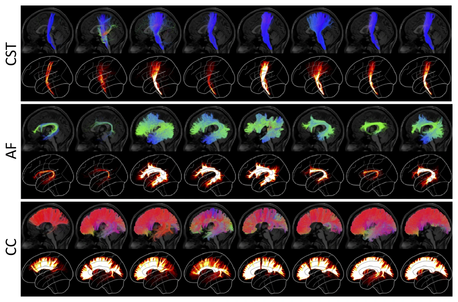 Different bundle-dissection protocols yield different reconstructions from the same tractogram.