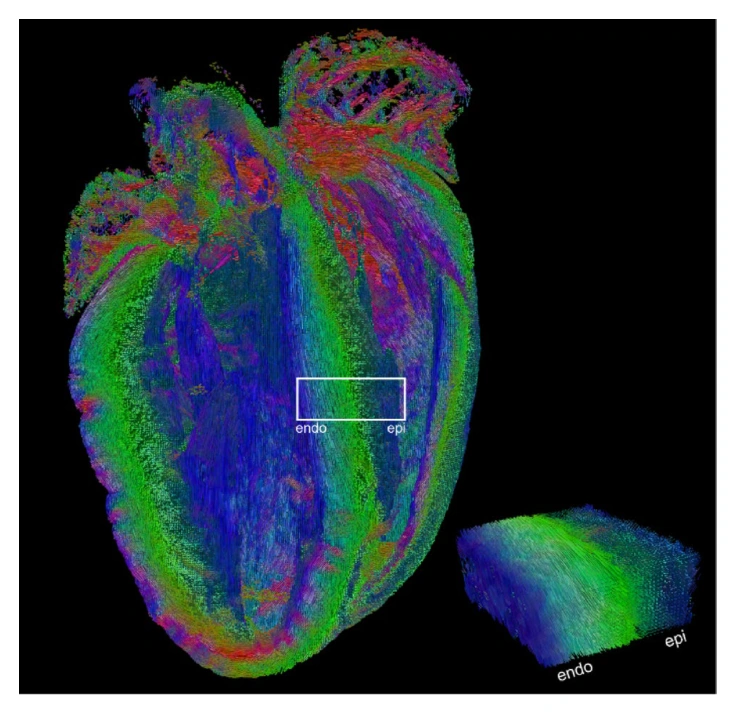 Ex vivo mouse heart tractography shows the changing orientation of cardiomyocytes through the ventricular wall.
