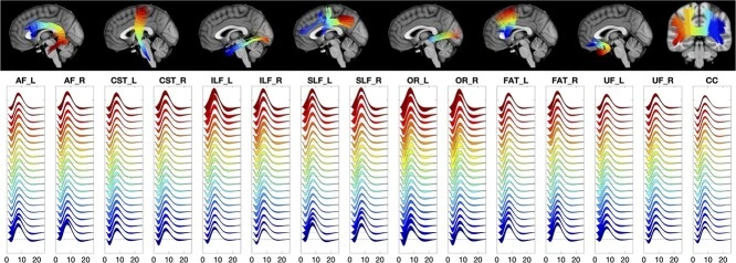 Hemodynamic response functions vary across and along white matter pathways.