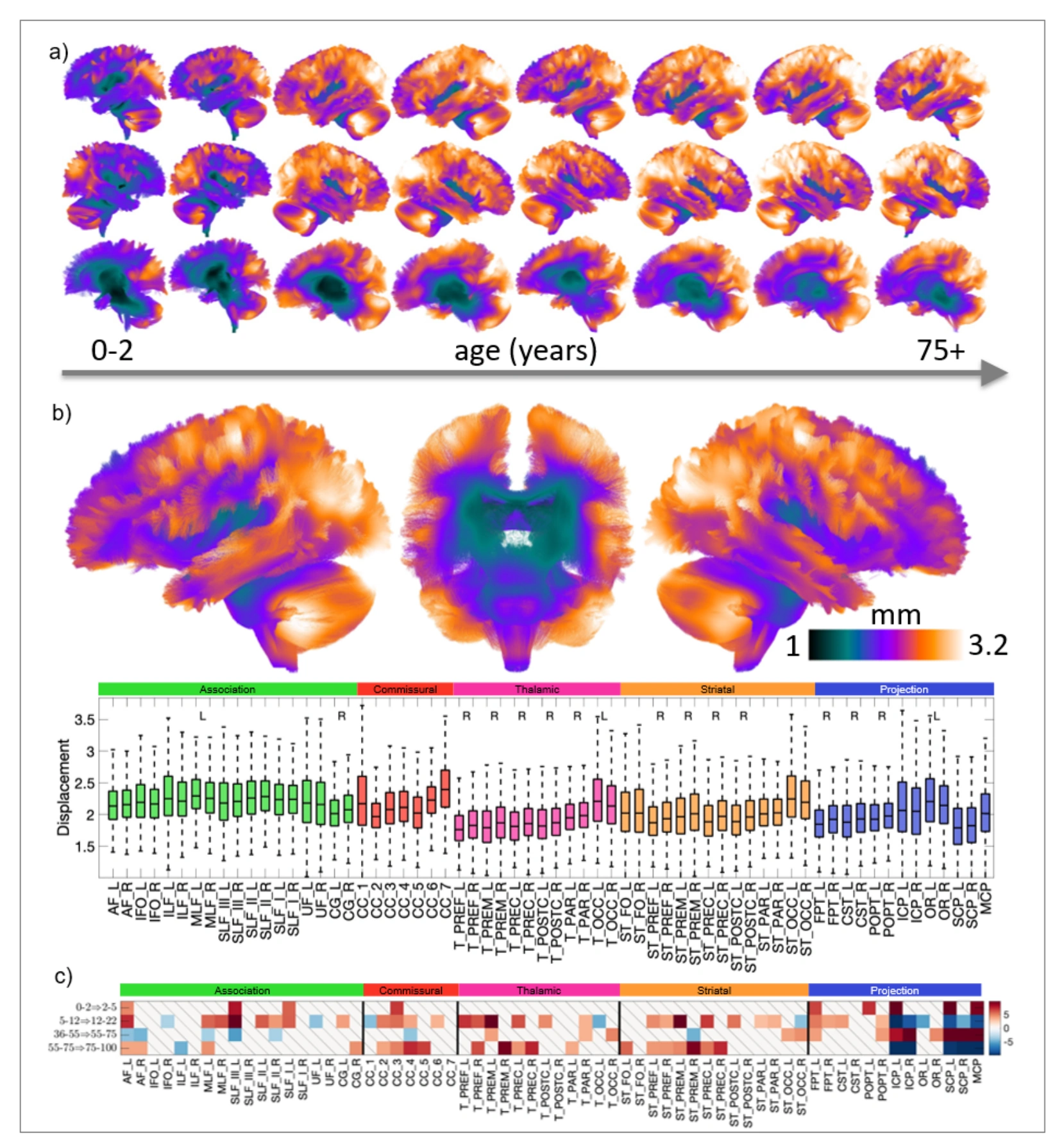 Spatial variability in white matter pathways across the brain and across lifespan cohorts.