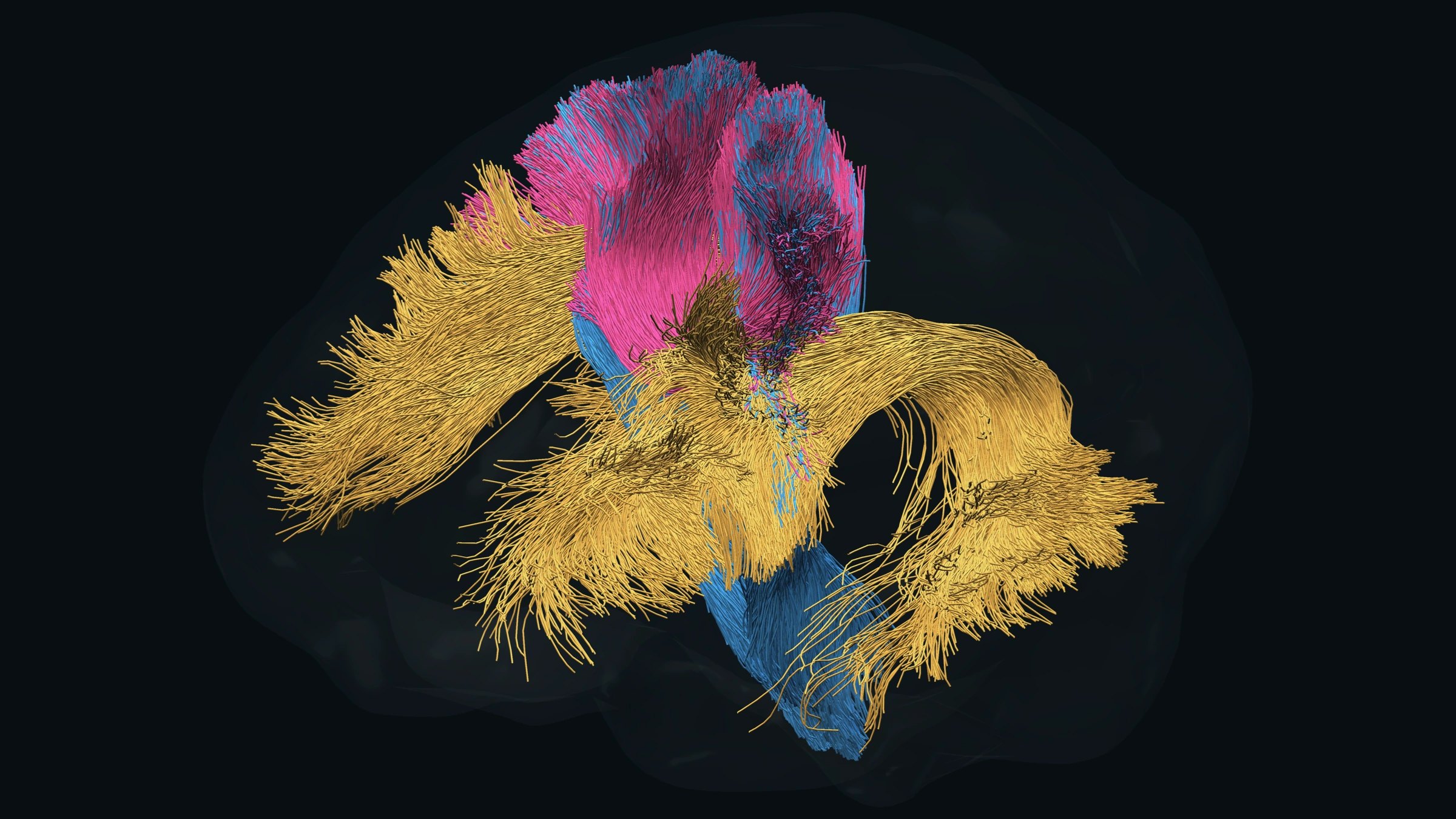 Reconstructed white matter pathways inside the matching transparent brain