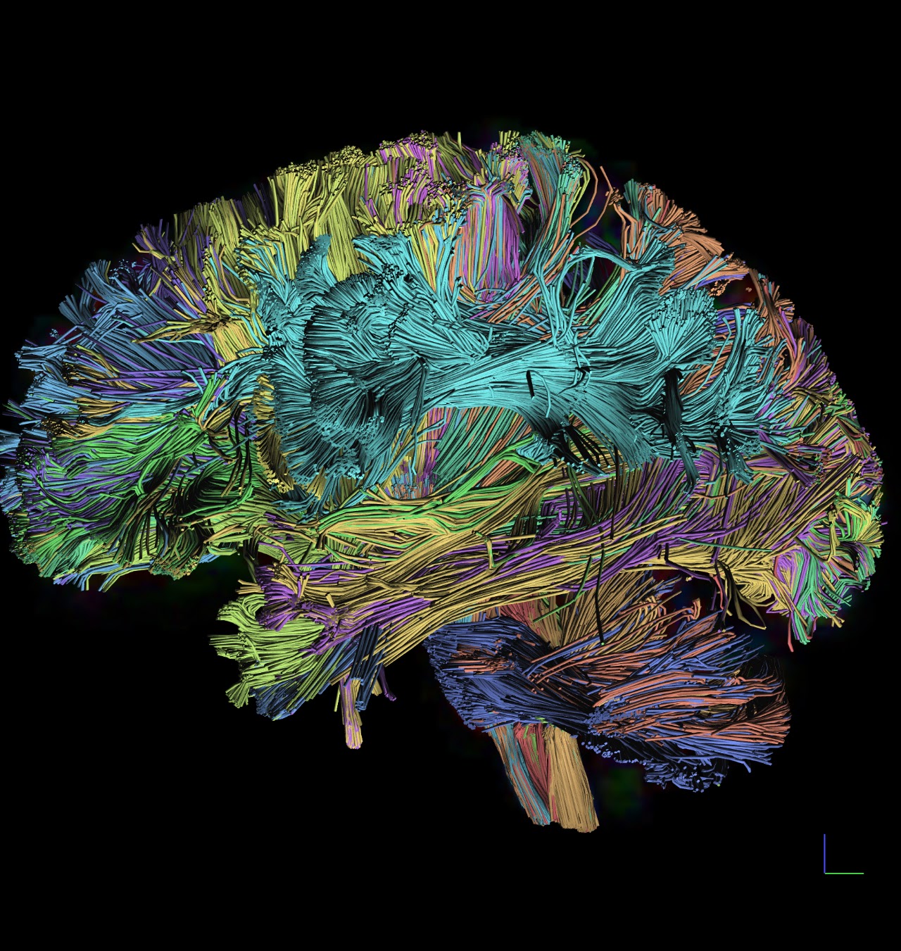 Color-coded white matter pathways from the lab’s tractography research